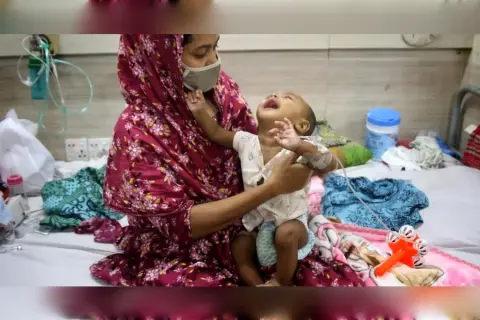 measles-death-toll-rises-9-children-die-one-day.webp