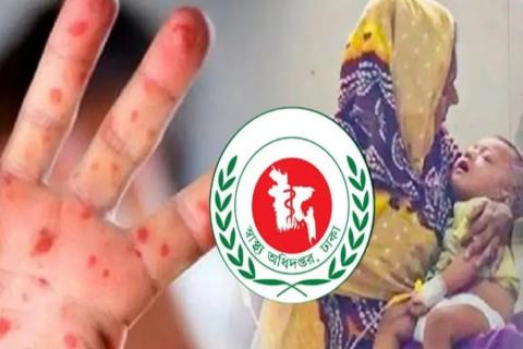 measles-outbreak-13-more-children-die-death-toll-crosses-5009672.jpg